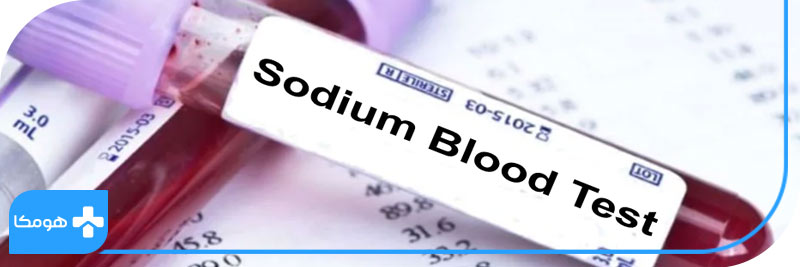 sodium blod test